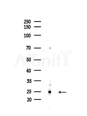 EIF4H Antibody - Western blot analysis of lysates from LoVo cells(heat-shock,45min treatment), using EIF4H Antibody at 1/1000 dilution.