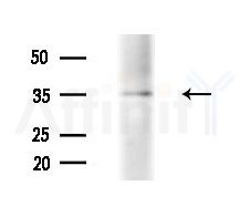 ENOPH1 Antibody - Western blot analysis of extracts from Mouse liver, using ENOPH1 Antibody at 1/1000 dilution.