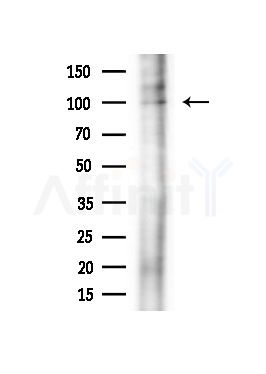 EXOC6 Antibody - Western blot analysis of extracts from Rat brain, using EXOC6 Antibody at 1/1000 dilution.