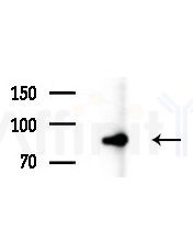 EXOSC10 Antibody - Western blot analysis of extracts from various samples, using EXOSC10 Antibody at 1/1000 dilution.
