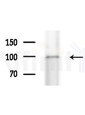 EXOSC10 Antibody - Western blot analysis of extracts from Rat brain, using EXOSC10 Antibody at 1/1000 dilution.