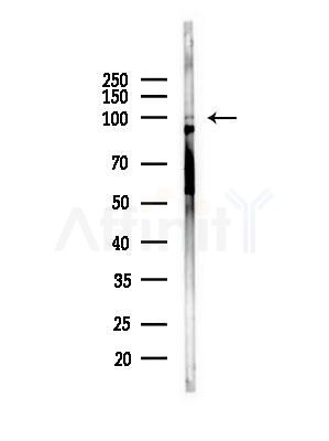 EXOSC10 Antibody - Western blot analysis of lysates from Rat brain, using EXOSC10 Antibody at 1/1000 dilution.