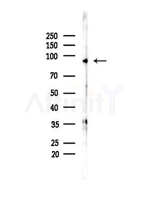 EXOSC10 Antibody - Western blot analysis of lysates from B16F10-LUC cells(LPS,4h treatment), using EXOSC10 Antibody at 1/1000 dilution.