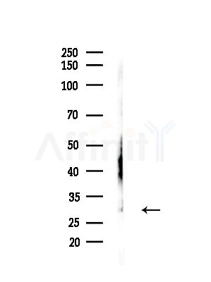 EXOSC4 Antibody - Western blot analysis of lysates from LoVo cells(heat-shock,45min treatment), using EXOSC4 Antibody at 1/1000 dilution.