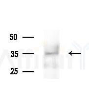 FA2H Antibody - Western blot analysis of extracts from various samples, using FA2H Antibody at 1/1000 dilution.
