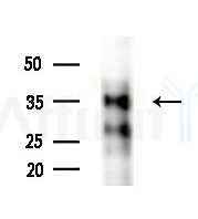 FA2H Antibody - Western blot analysis of extracts from PC12 cells(starvation treatment), using FA2H Antibody at 1/1000 dilution.