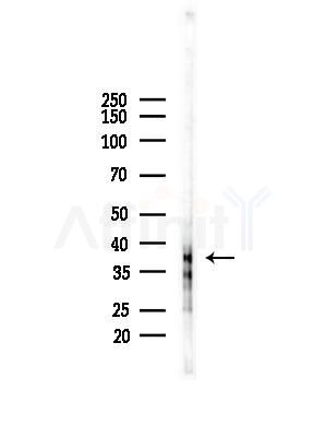 FA2H Antibody - Western blot analysis of lysates from PC12 cells(starvation treatment), using FA2H Antibody at 1/1000 dilution.