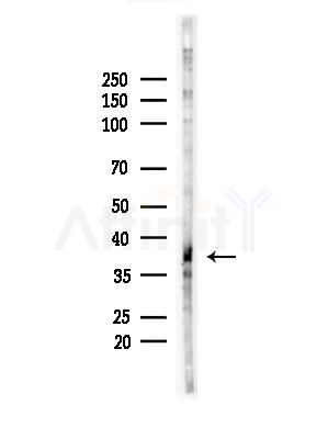 FA2H Antibody - Western blot analysis of lysates from B16F10-LUC cells(LPS,4h treatment), using FA2H Antibody at 1/1000 dilution.