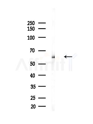 FAM124B Antibody - Western blot analysis of lysates from LoVo cells(heat-shock,45min treatment), using FAM124B Antibody at 1/1000 dilution.