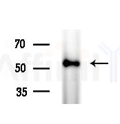 FAM134B Antibody - Western blot analysis of extracts from various samples, using FAM134B Antibody at 1/1000 dilution.