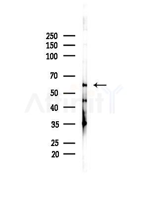 FAM134B Antibody - Western blot analysis of lysates from B16F10-LUC cells(LPS,4h treatment), using FAM134B Antibody at 1/1000 dilution.