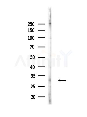 FAM92A1 Antibody - Western blot analysis of lysates from B16F10-LUC cells(heat-shock,45min treatment), using FAM92A1 Antibody at 1/1000 dilution.