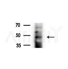 FBXL14 Antibody - Western blot analysis of extracts from A375 cells(heat-shock,45min treatment), using FBXL14 Antibody at 1/1000 dilution.