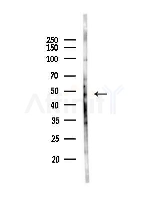 FBXL14 Antibody - Western blot analysis of lysates from A375 cells(heat-shock,45min treatment), using FBXL14 Antibody at 1/1000 dilution.
