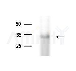 FBXO17 Antibody - Western blot analysis of extracts from various samples, using FBXO17 Antibody at 1/1000 dilution.