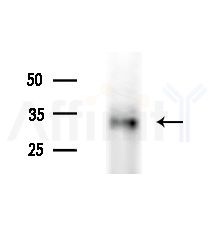 FBXO17 Antibody - Western blot analysis of extracts from PC12 cells(starvation treatment), using FBXO17 Antibody at 1/1000 dilution.