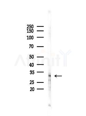 FBXO17 Antibody - Western blot analysis of lysates from PC12 cells(starvation treatment), using FBXO17 Antibody at 1/1000 dilution.