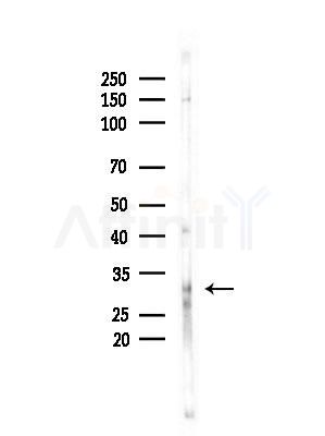 FBXO17 Antibody - Western blot analysis of lysates from B16F10-LUC cells(LPS,4h treatment), using FBXO17 Antibody at 1/1000 dilution.