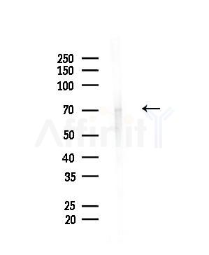 FBXO7 Antibody - Western blot analysis of lysates from A375 cells(heat-shock,45min treatment), using FBXO7 Antibody at 1/1000 dilution.