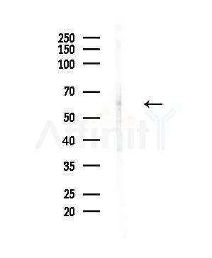 FBXO7 Antibody - Western blot analysis of lysates from Hela cells(UV,30min treatment), using FBXO7 Antibody at 1/1000 dilution.