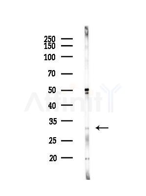 FHL2 Antibody - Western blot analysis of lysates from EC304 cells(heat-shock,45min treatment), using FHL2 Antibody at 1/1000 dilution.