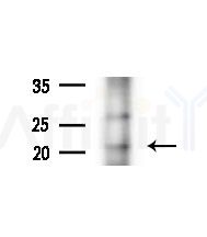 FNDC5 Antibody - Western blot analysis of extracts from A375 cells(heat-shock,45min treatment), using FNDC5 Antibody at 1/1000 dilution.