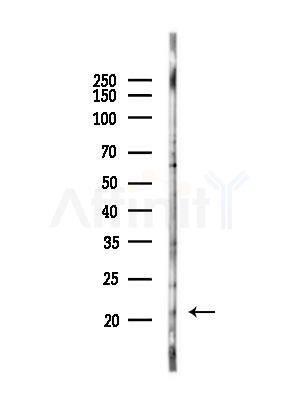 FNDC5 Antibody - Western blot analysis of lysates from A375 cells(heat-shock,45min treatment), using FNDC5 Antibody at 1/1000 dilution.