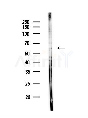 GALNT14 Antibody - Western blot analysis of lysates from Rat brain, using GALNT14 Antibody at 1/1000 dilution.