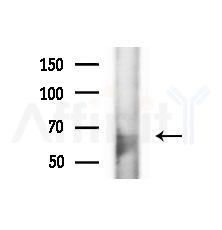 GALNT4 Antibody - Western blot analysis of extracts from Rat brain, using GALNT4 Antibody at 1/1000 dilution.