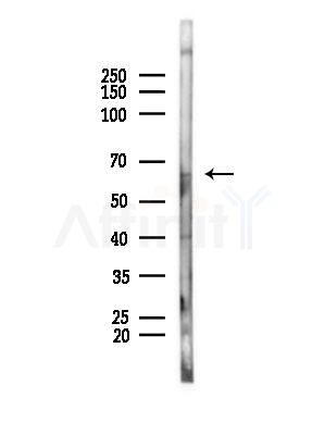 GALNT4 Antibody - Western blot analysis of lysates from Rat brain, using GALNT4 Antibody at 1/1000 dilution.