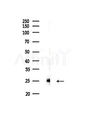 GGCT Antibody - Western blot analysis of lysates from Rat brain, using GGCT Antibody at 1/1000 dilution.
