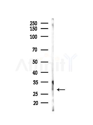 GINS3 Antibody - Western blot analysis of lysates from Hela cells(heat-shock,45min treatment), using GINS3 Antibody at 1/1000 dilution.