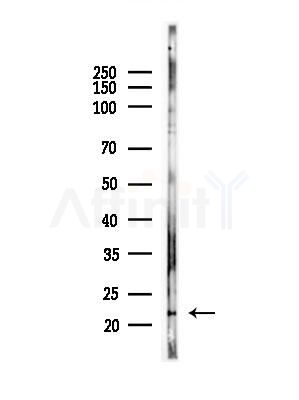 GLTP Antibody - Western blot analysis of lysates from Rat brain, using GLTP Antibody at 1/1000 dilution.