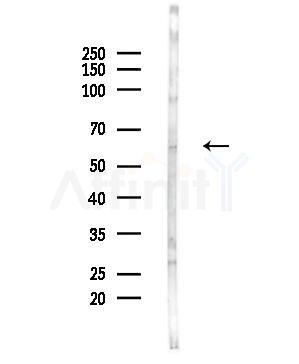 Glypican1 Antibody - Western blot analysis of lysates from Hela cells(UV,30min treatment), using Glypican1 Antibody at 1/1000 dilution.