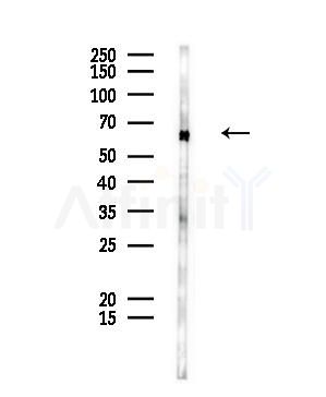 Glypican1 Antibody - Western blot analysis of lysates from Rat liver, using Glypican1 Antibody at 1/1000 dilution.