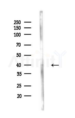 GNAI2 Antibody - Western blot analysis of lysates from MCF7 cells(heat-shock,45min treatment), using GNAI2 Antibody at 1/1000 dilution.