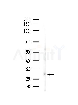 GNPDA1 Antibody - Western blot analysis of lysates from Hela cells(heat-shock,45min treatment), using GNPDA1 Antibody at 1/1000 dilution.