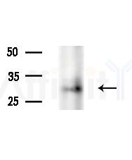 GNPDA2 Antibody - Western blot analysis of extracts from PC12 cells(starvation treatment), using GNPDA2 Antibody at 1/1000 dilution.
