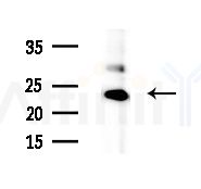 GNPNAT1 Antibody - Western blot analysis of extracts from Mouse liver, using GNPNAT1 Antibody at 1/1000 dilution.