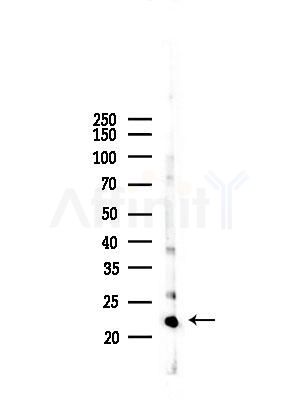 GNPNAT1 Antibody - Western blot analysis of lysates from Mouse liver, using GNPNAT1 Antibody at 1/1000 dilution.