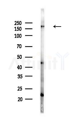 GOLGA3 Antibody - Western blot analysis of lysates from MCF7 cells(heat-shock,45min treatment), using GOLGA3 Antibody at 1/1000 dilution.