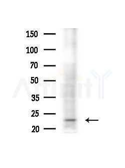 GPX8 Antibody - Western blot analysis of extracts from Mouse liver, using GPX8 Antibody at 1/1000 dilution.