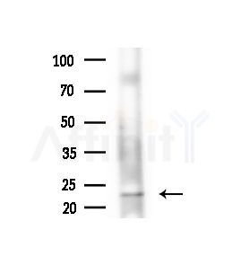 GPX8 Antibody - Western blot analysis of extracts from Rat brain, using GPX8 Antibody at 1/1000 dilution.
