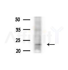 GPX8 Antibody - Western blot analysis of extracts from Hela cells(heat-shock,45min treatment), using GPX8 Antibody at 1/1000 dilution.