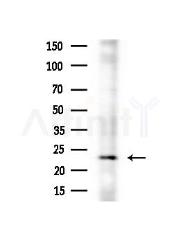 GPX8 Antibody - Western blot analysis of extracts from A375 cells(heat-shock,45min treatment), using GPX8 Antibody at 1/1000 dilution.