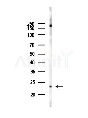 GPX8 Antibody - Western blot analysis of lysates from A375 cells(heat-shock,45min treatment), using GPX8 Antibody at 1/1000 dilution.