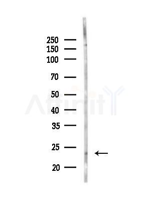GPX8 Antibody - Western blot analysis of lysates from Hela cells(heat-shock,45min treatment), using GPX8 Antibody at 1/1000 dilution.