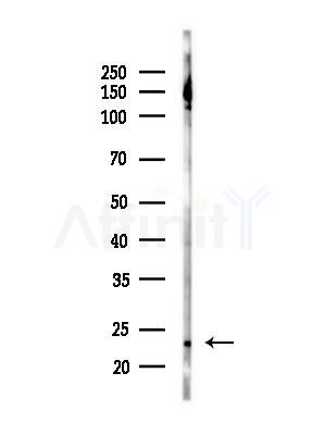 GPX8 Antibody - Western blot analysis of lysates from Mouse liver, using GPX8 Antibody at 1/1000 dilution.
