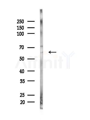 HAS3 Antibody - Western blot analysis of lysates from RAW264.