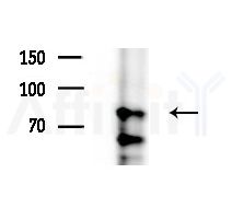 HNRNPR Antibody - Western blot analysis of extracts from various samples, using HNRNPR Antibody at 1/1000 dilution.